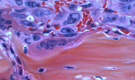 МорфОнко-2025