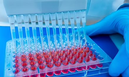 Новый способ диагностики мочекаменной болезни