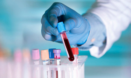 «Молекулярные часы» для предсказания Альцгеймера 